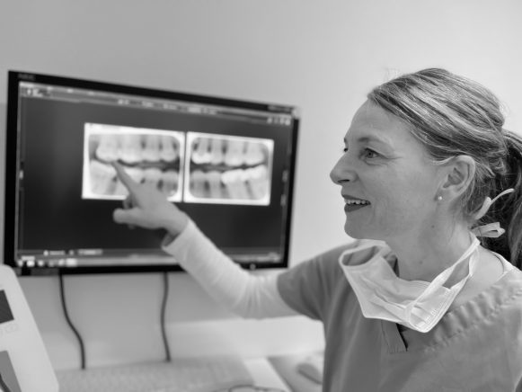 Beauty Aligner in Gehrden Unsichtbare Zahnkorrektur ohne Metall